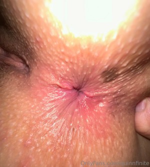 Quinn Finite Photo #170