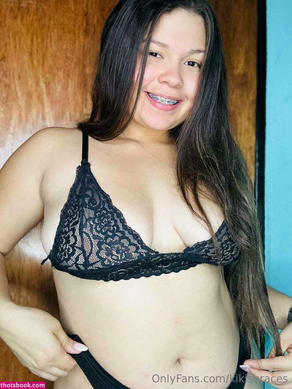 kikisbraces Photo #12