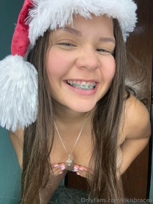 kikisbraces Photo #42