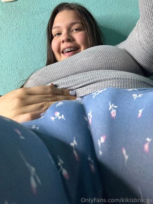 kikisbraces Photo #77