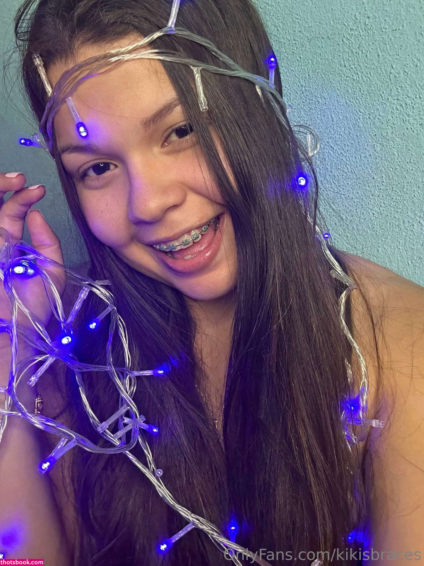 kikisbraces Photo #81