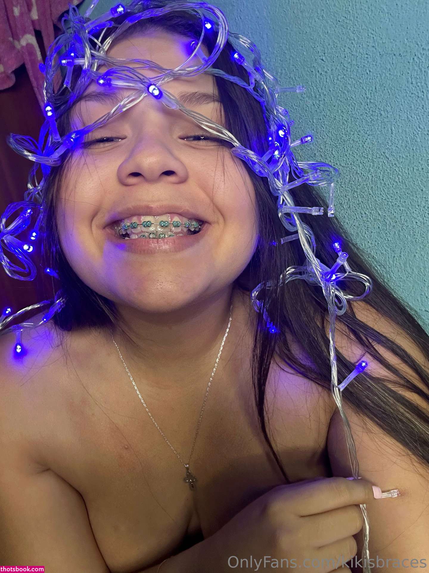 kikisbraces Photo #82