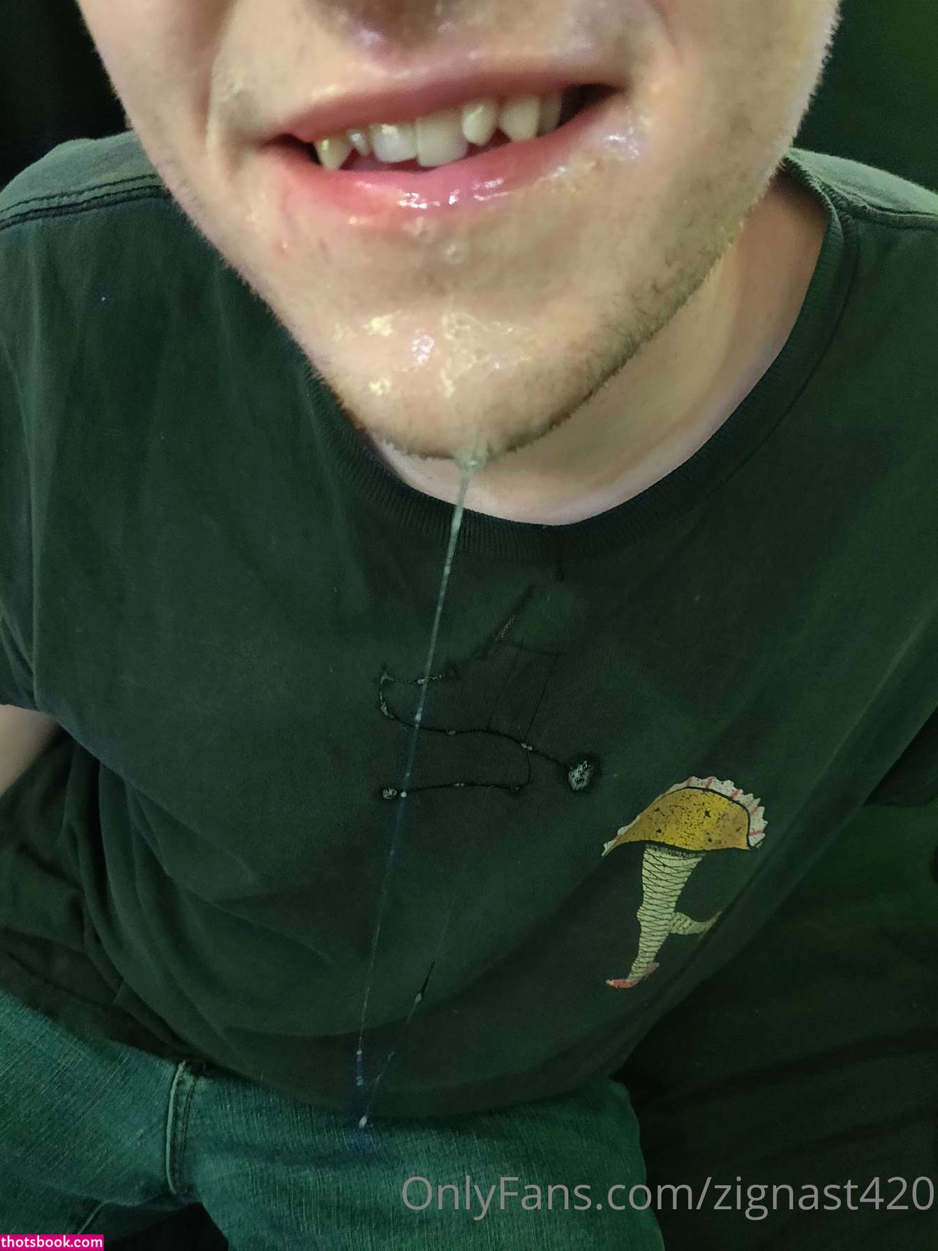 zignast420 Photo #29