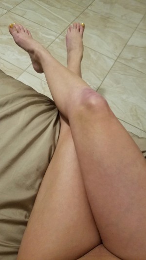 Kate England Photo #348