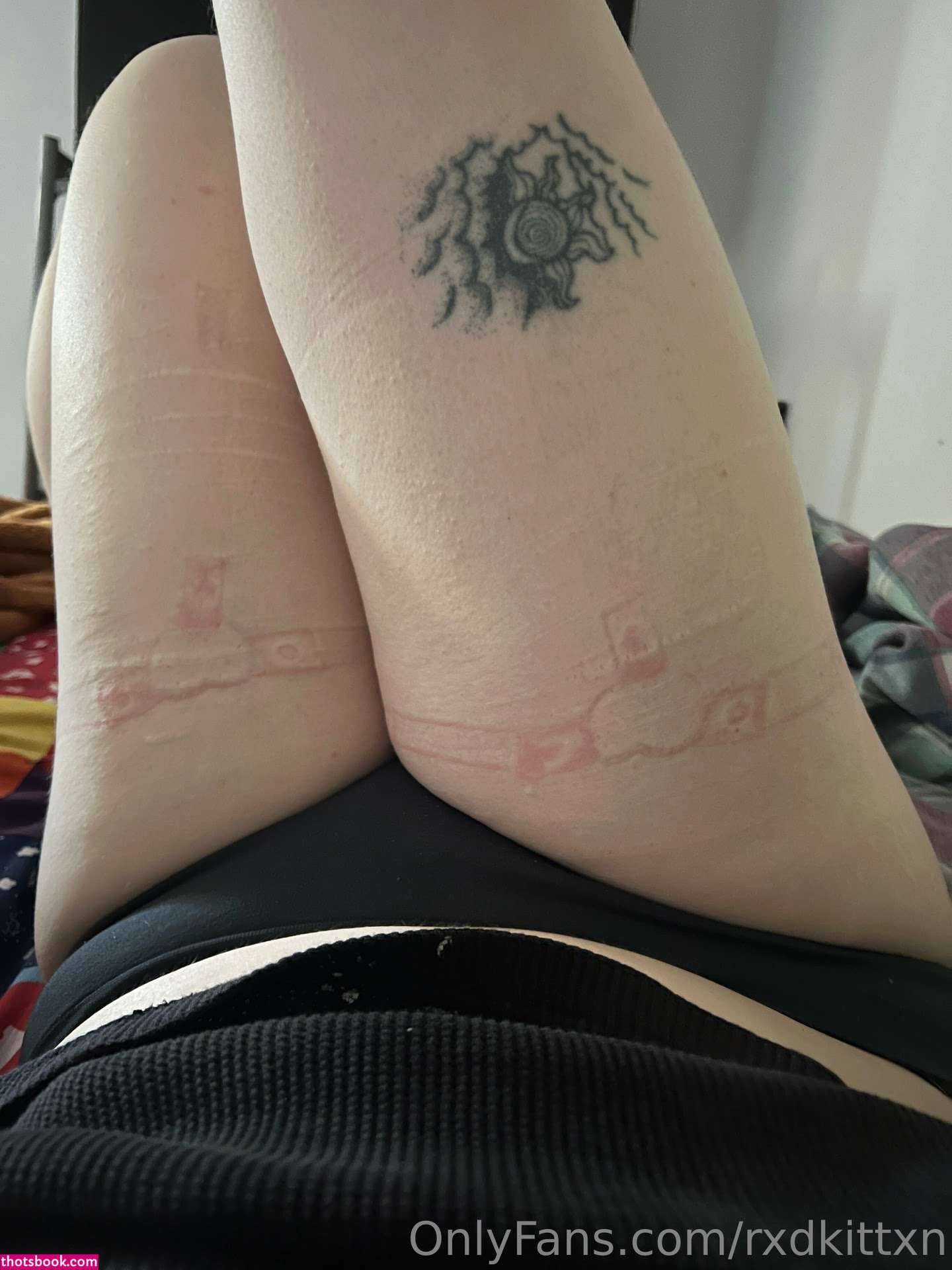 Rxdkittxn Photo #168