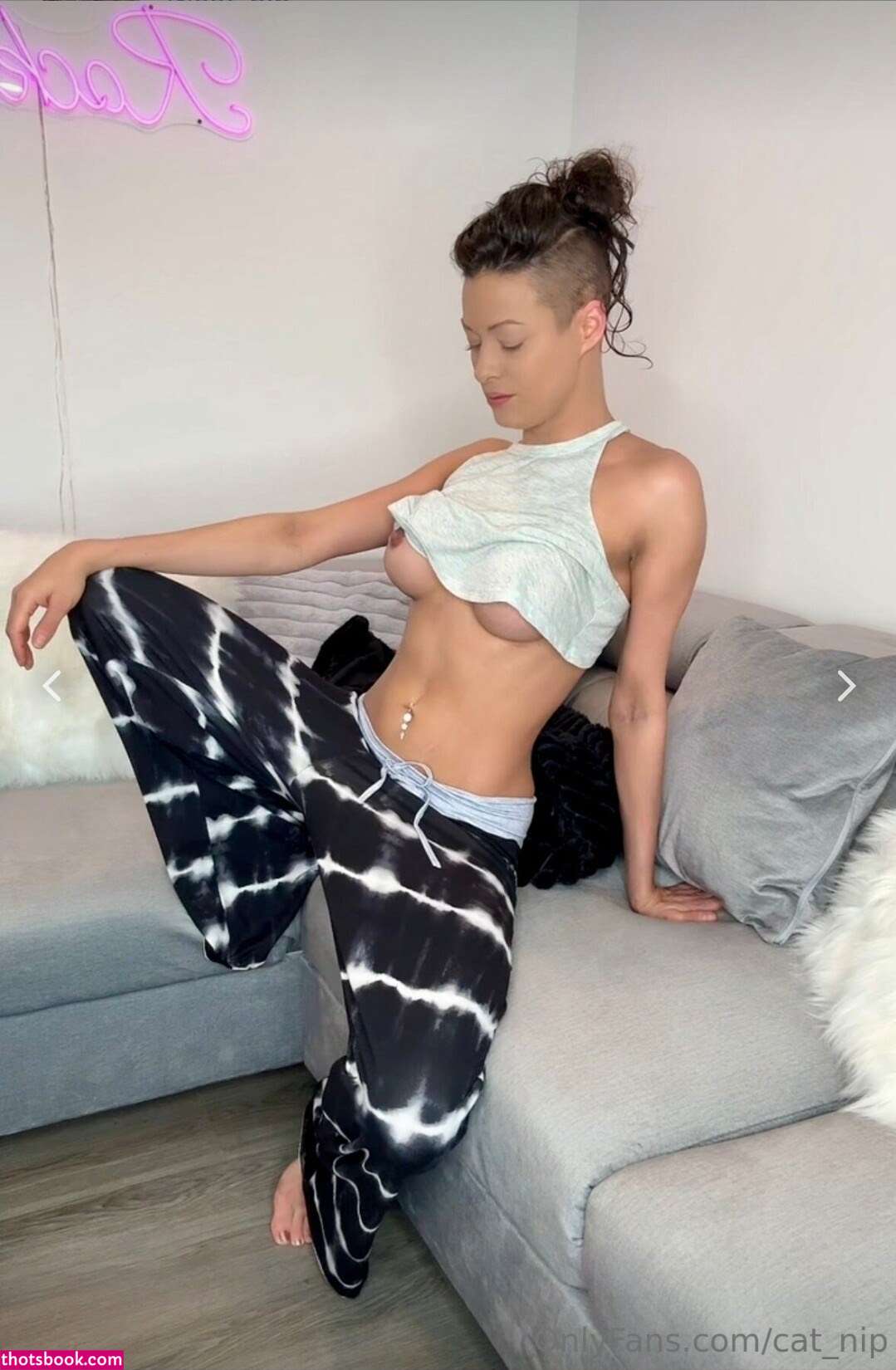 Rocking Alopecia Photo #50