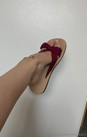 tinytwinklers Photo #29