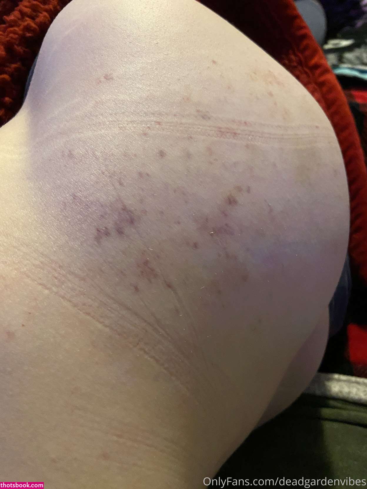 deadgardenvibes Photo #23