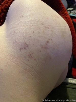 deadgardenvibes Photo #23