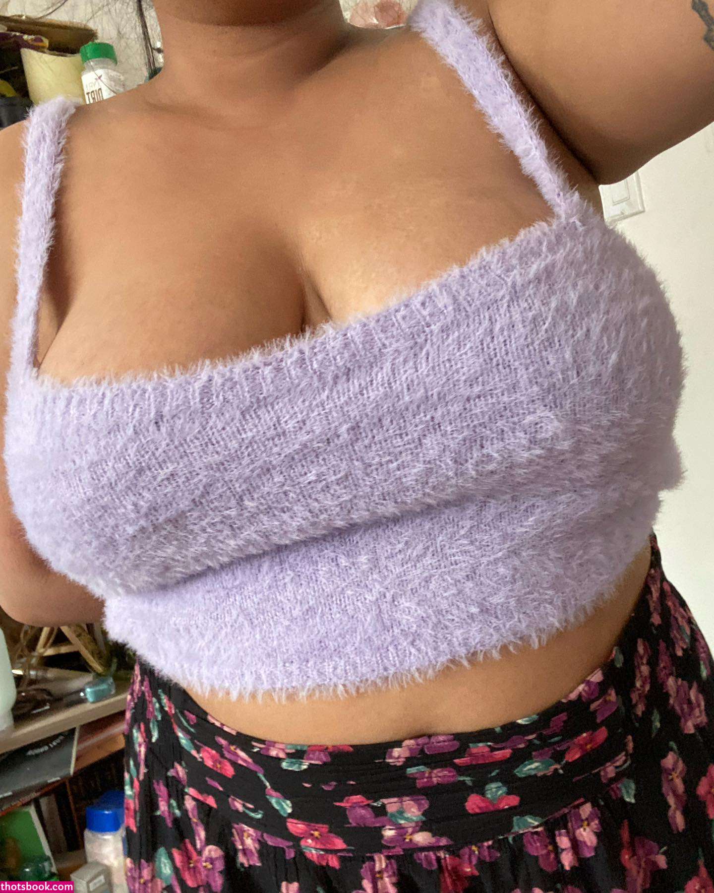 vitiligo kitten Nude Leaks OnlyFans Photos #1 1914266