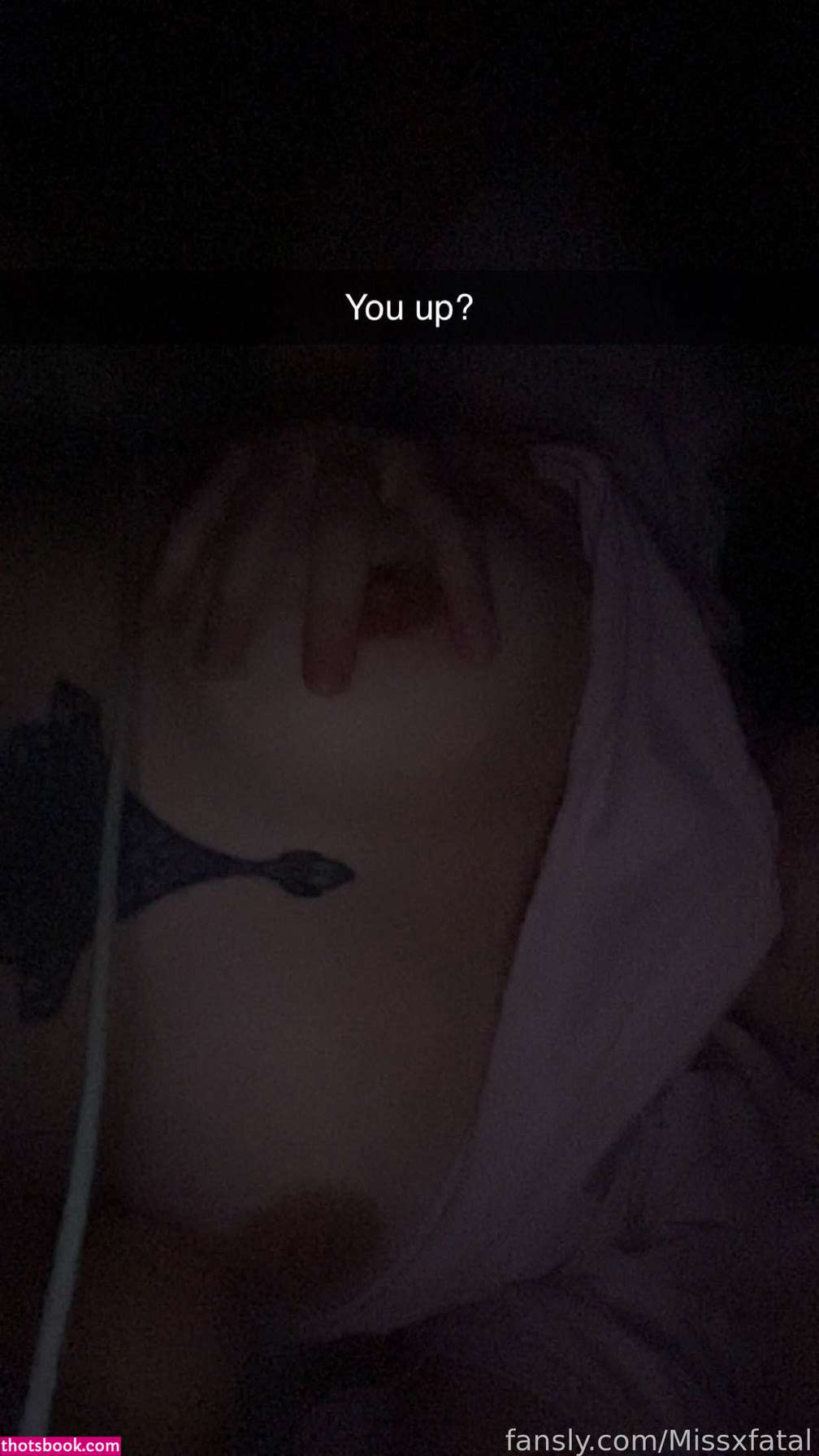 Missxfatal uwuamia Nude Leaks OnlyFans Photos #4 1835049